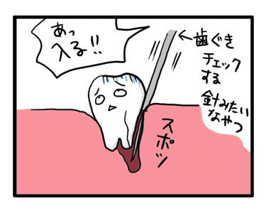 歯　抜歯　ひび　治療　割れ　イラスト　漫画